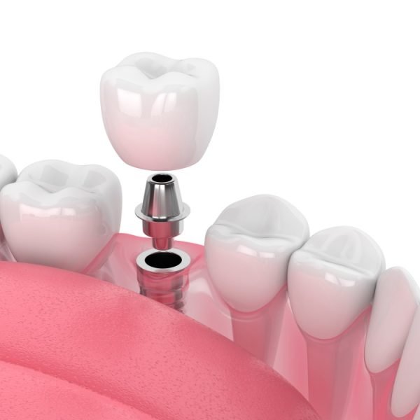 Cirugía Maxilofacial