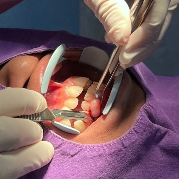 Cirugía Maxilofacial(Serv2)