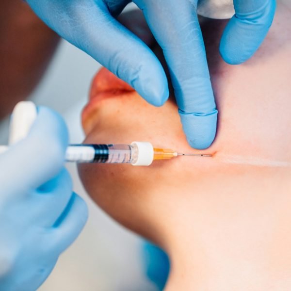 Cirugía Maxilofacial(Serv3)
