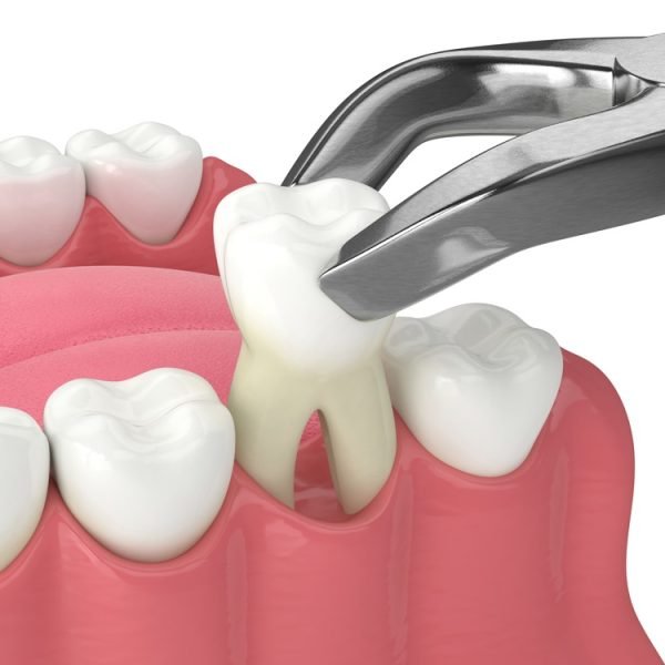 Cirugía Maxilofacial(Serv5)